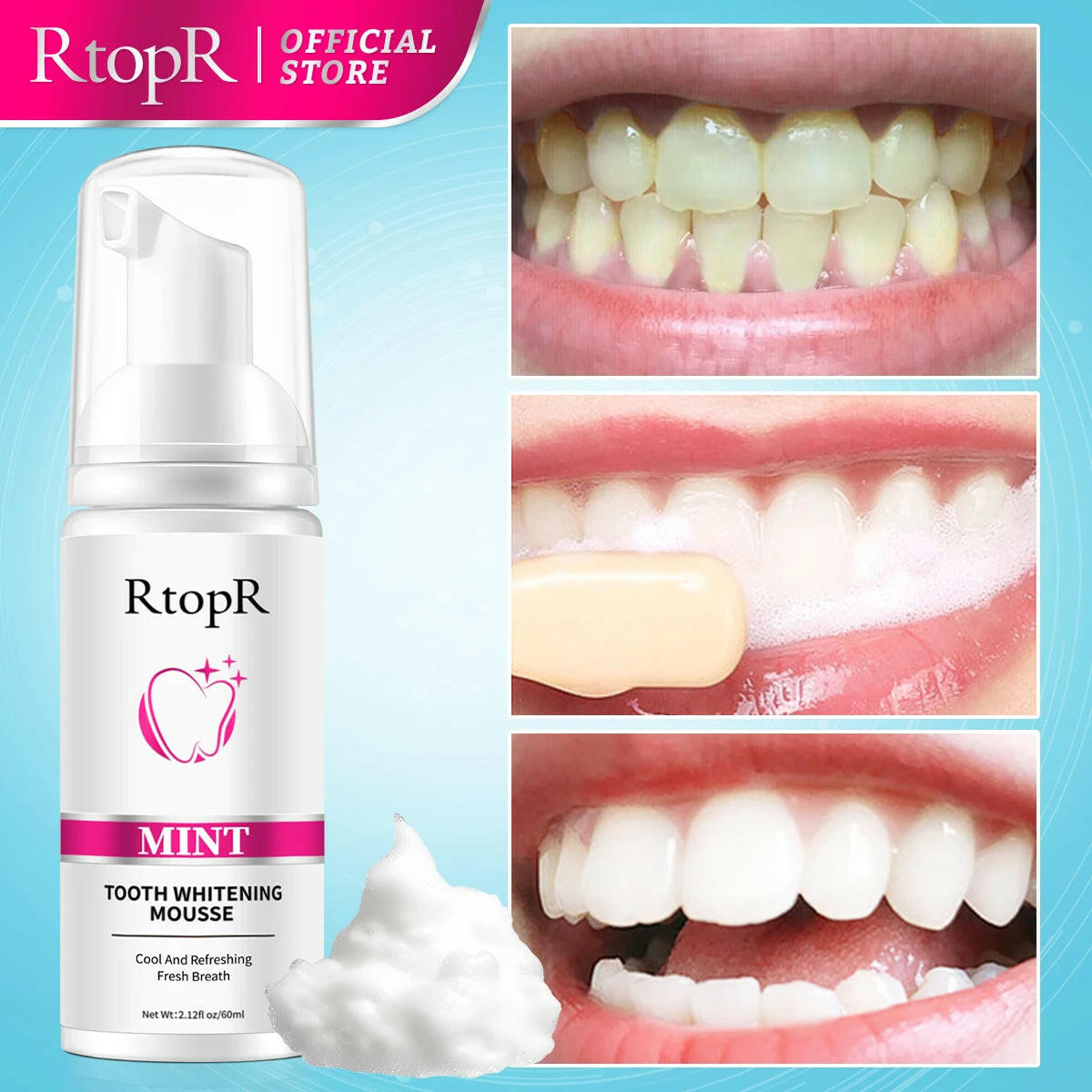 RtopR tooth whitening mousse with before and after effects on teeth against a blue background